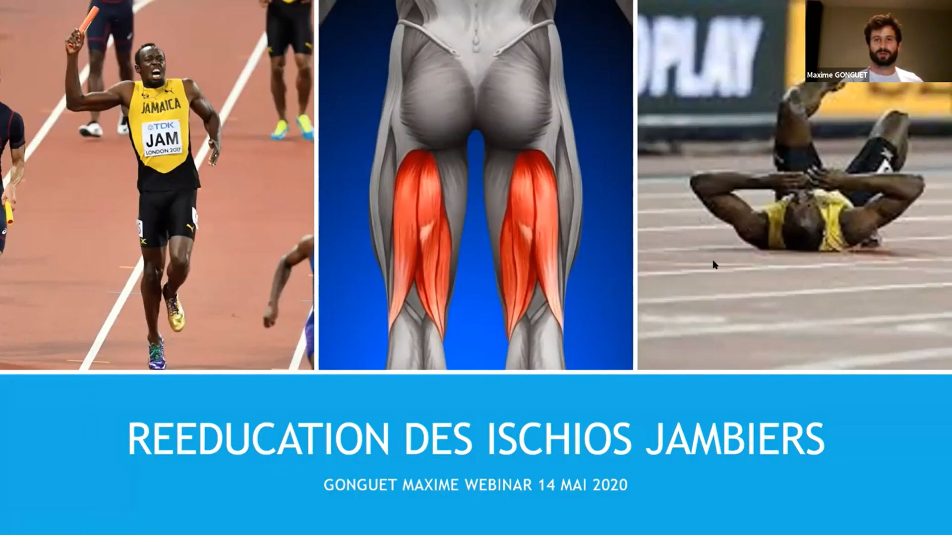 Ischio Jambiers Rééducation : Les lésions musculaires des ischio ...